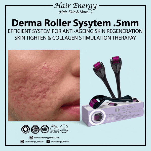 Derma Roller System 0.5 Mm Hair & Skin Care